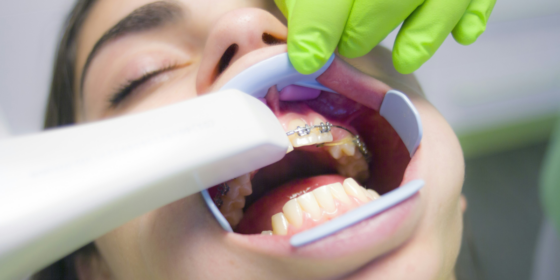 4 Dental Problems That Arise From Not Flossing Your Teeth